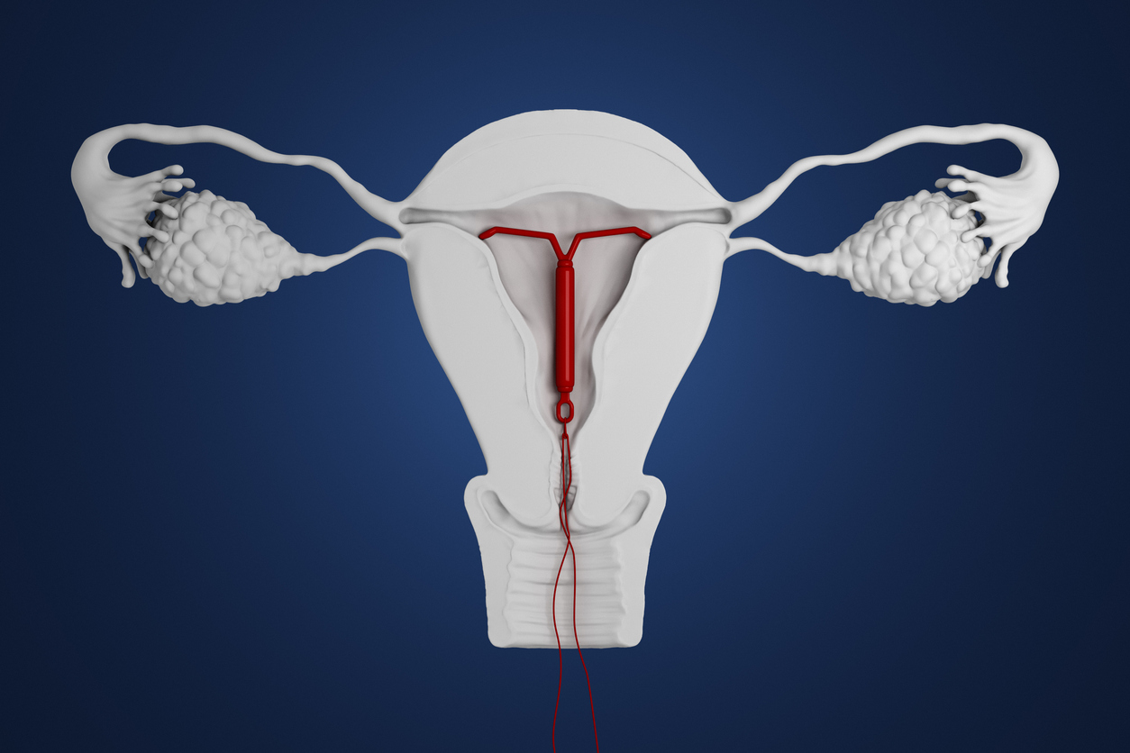 What Really Goes On Down There?: IUD Placement | Dr. Susan Fox