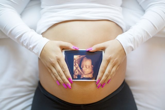 Pregnant woman holding a 3D ultrasound image in front of her belly.